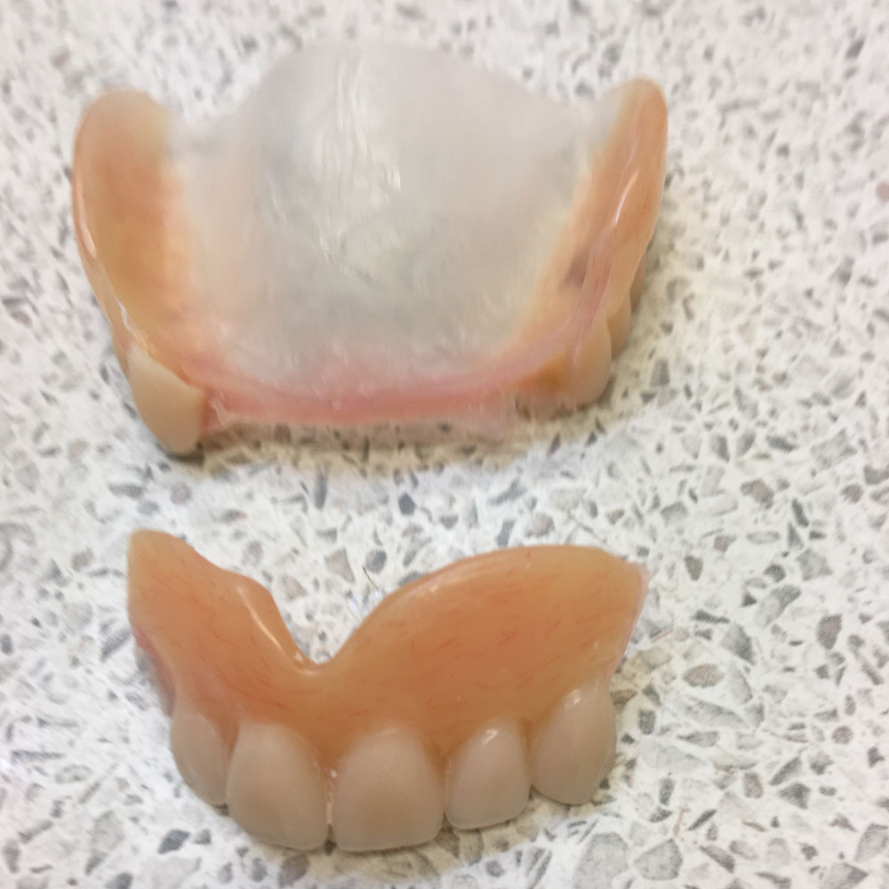 Repairs from The Denture Clinic, Deal