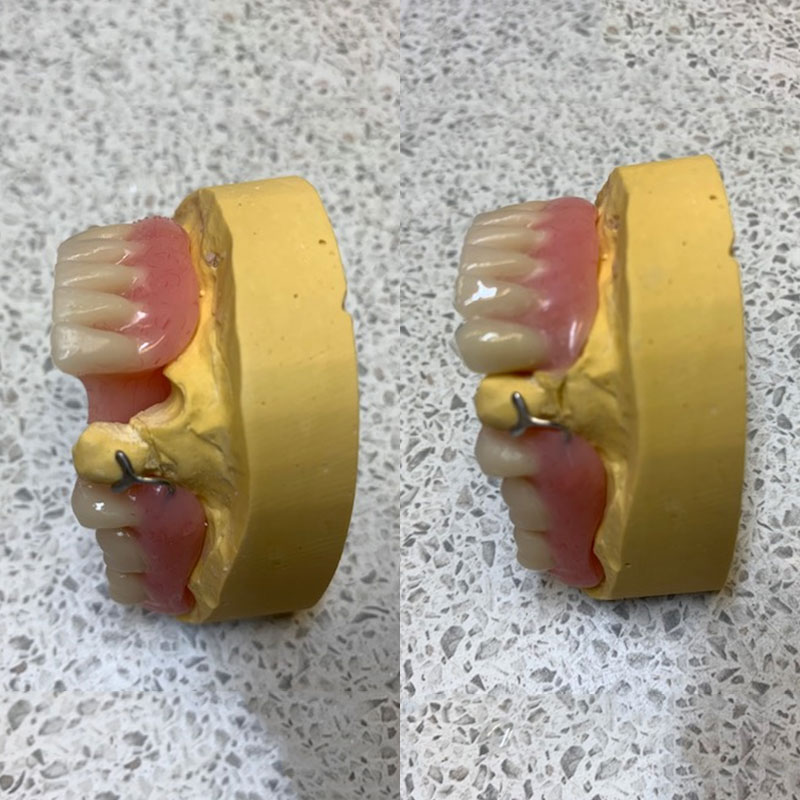 Additions from The Denture Clinic, Deal