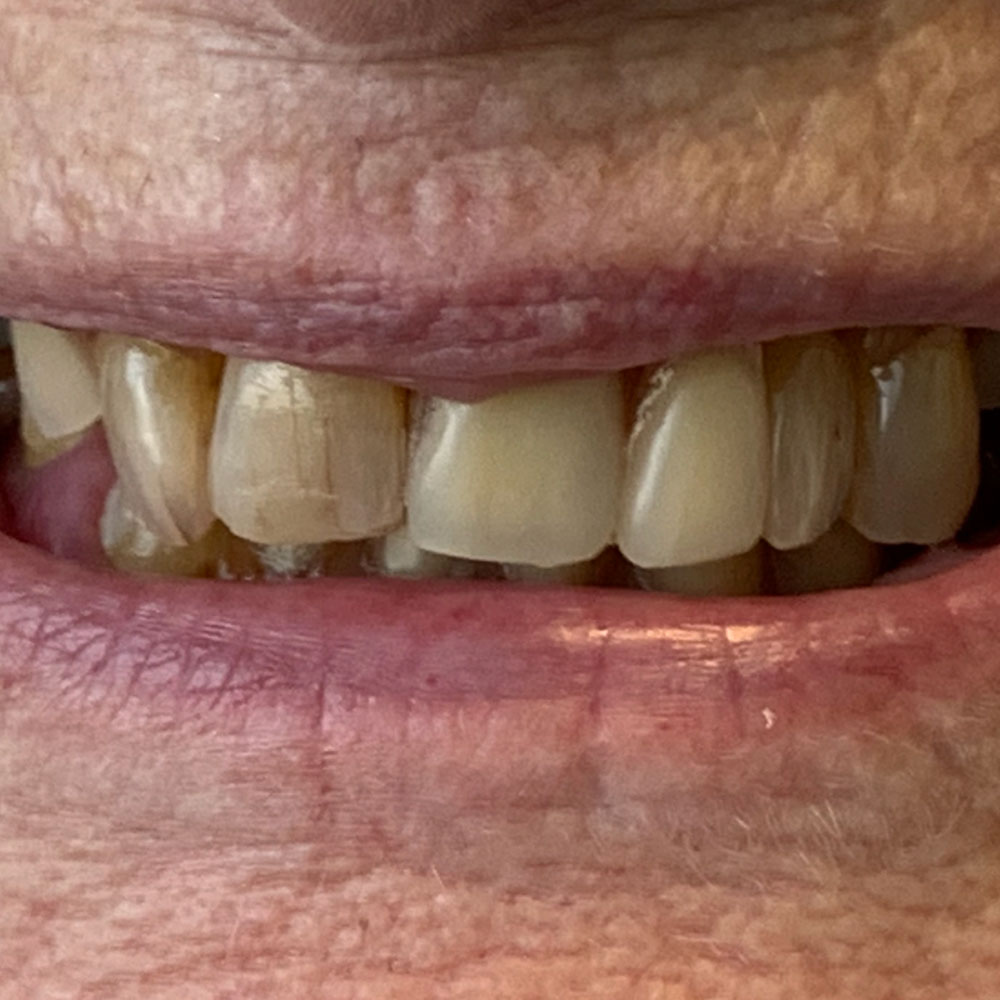 Service 1 - The Denture Clinic, Deal